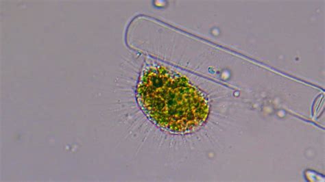 Vampyrella! This Tiny Mastigophoran Makes a Feast of Algae and Other Protists Like a Microscopic Dracula